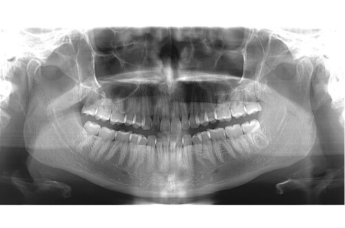 Cone Beam Ct Scan: A New Era for Diagnosis & Treatment | Facial Imaging ...